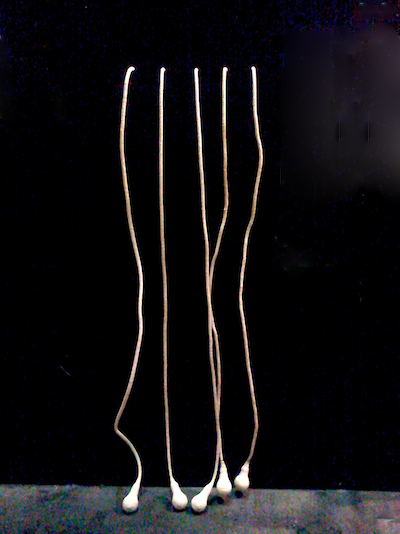 veins1